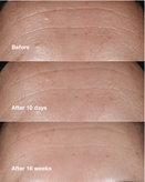 سرم ضدچروک کلینیک مدل Smart Clinical Repair Wrinkle Correcting